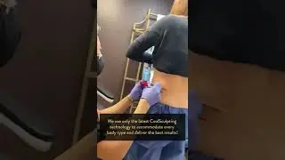 Coolsculpting assesment with Dr. Tom