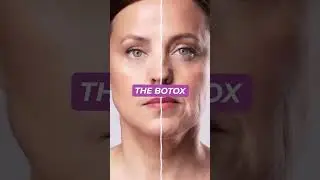 BEST Alternatives to Botox! 🕰️  ✨