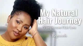 My Postpartum Hair Loss Nightmare: The Journey to Regrowth