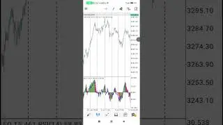 The Safest Forex Strategy for Consistent Profit #SafeTrading #ForexPlan #SteadyGains