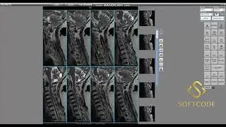 SOFTCODE 1.0 Recharge DICOM Printing Software #dicom #windows #medical #software #CT #mri  #xray
