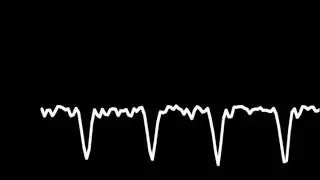 Music From Plants - Periodical Signal Wave Study