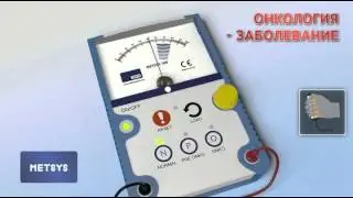 Metsys Диагностика рака. Онкология. Заболевание.