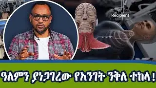 ከሞተ ሰው አንገት መውሰድ ሊጀመር ነው! _ |ከአዕምሮ ትዕዛዝ የሚቀበለው አርቲፊሻል እግር!   |Dotcom Tv Show@NBCETHIOPIA