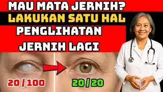 Atasi Mata Buram & Katarak Secara Alami &ndash; Rahasia Sederhana untuk Usia 50+!