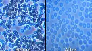 eamega - Blood Analysis