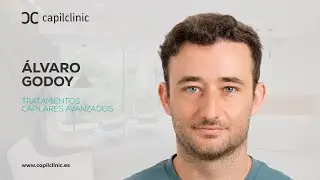 Injerto capilar: el antes y después de Álvaro en Capilclinic