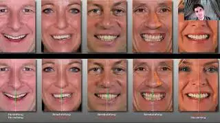 Digital smile design( DSD)