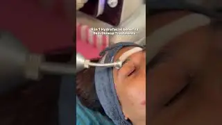 9 Steps to Your Best Skin Ever &ndash; Hydrafacial | Luxskin