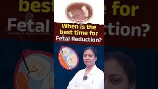 When Should Fetal Reduction Be Done? | Expert Advice by Dr. Neeraja, Fertility Specialist