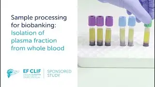 Sample processing for biobanking: Isolation of plasma fraction from whole blood