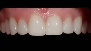 Best Dentist In Beverly Hills | DR. RODNEY RAANAN DDS MMSc