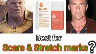 Bio oil review | Remove stretch & Scar marks | Bio oil benefits & Side effects | @pharmatank5632
