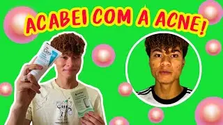 LIMPEZA PARA A ACNE COM GARNIER , CERAVE, ACTINE, SALLVE, LA ROCHE POSAY E ADESIVO DE HIDROCOLOIDE!