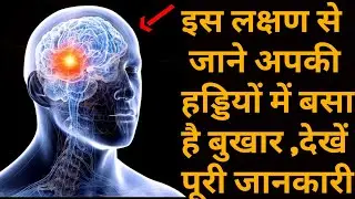 Fever Go Syrup, पुराने से पुराना बुखार अब होगा ठीक, मलेरिया, हड्डियों में बसा बुखार जड़ से खत्म