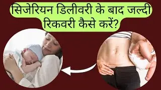 C-section Recovery Tips | How to recover quickly after a cesarean delivery