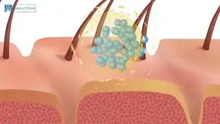 Animation: 2149 - MultiSal Retinol