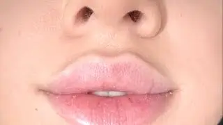 💉 ( 𝑒𝓍𝓅 ) micro-philtrum shortening ⋆˙ ୨୧ hyperfeminine effect