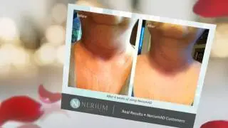Punta Gorda Day Spa | Nerium Before and After | Dr. Michael