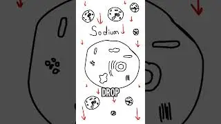What would happen if you drink 100 gallons of water?