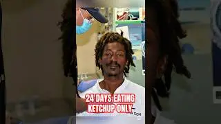 Guy Who Survived Eating Ketchup Only #shorts #viralstory #bizarrenews