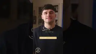 Ultra thin veneers - Matty Edgell