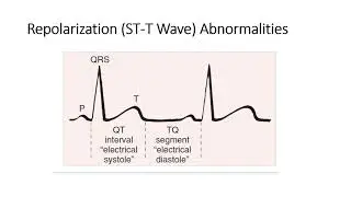 STEMI, STEMI equivalents and STEMI mimic