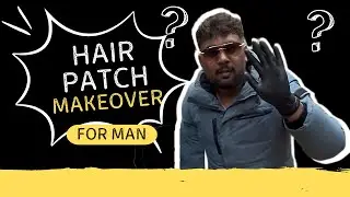 Instant Youth Boost! Hair Patch Makeover for Men | Hair Loss Solution (Ganjepan Solution)