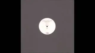 Anthony Difrancesco - Level 3