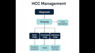 Dr. Muhammad Zakria. Consultant Hepatobiliary Surgeon. How to Manage Liver Cancer.