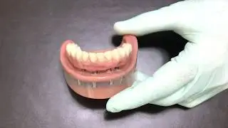 Pr&oacute;tese fixa:  vantagem e desvantagem