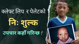 ✨Free Cleft Lip & Palate Surgery👄✨Before | After Result🤩🥰BPKIHS DHARAN👨🏻&zwj;⚕️🏥#smiletrain #bpkihs