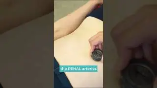Синяки на брюшной артерии #шорты