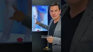 Varizes grossas s&oacute; resolvem com cirurgia?