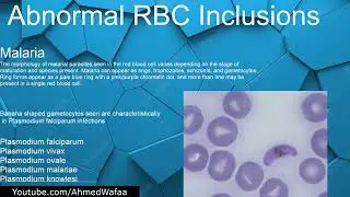 الحالات التي تسبب تتلف محتويات خلايا الدم الحمر Abnormal RBC inclusions الجزء 1