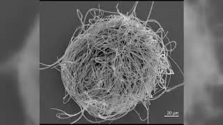 Scientists find world's oldest sperm in Myanmar amber