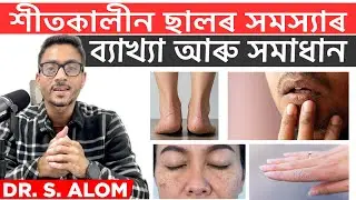 Your Skin Is Begging for Help &mdash; Winter Damage Explained