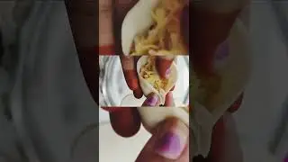 Easy Momos Recipe 😍| Tips, Problems & Solutions |#food #recipe #indian  #trending #cooking  #momos