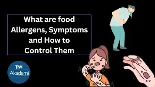 What are food Allergens, Symptoms of Food allergy and How to Control Food Allergens