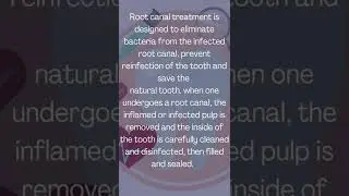 Root Canal Treatment . #snfmentor #shorts  #rootcanals
