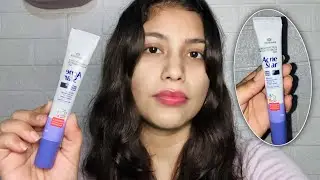 New Acne star Gel Review #acnestar #review 
