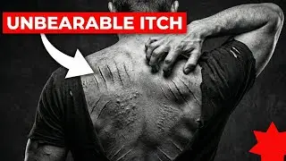 Why This &ldquo;Gentle&rdquo; British Powder Made U-Boat Crews Claw Their Own Skin Off in Minutes