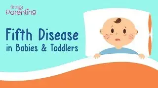 Slapped Cheek Syndrome (Fifth Disease) in Babies and Toddlers