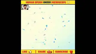 🤯OMG! human sperm a under microscope!🔬 | MH FactHub