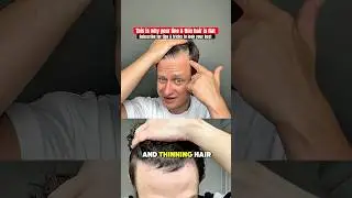 How to get fuller, thicker hair. Thinning hair hacks #menshair hair tutorial, hair growth hacks