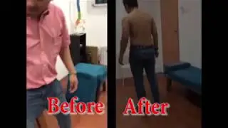 Bank Officer with ACUTE LOW BACK PAIN radiating to left leg HELPED by Physiotherapist Mok Cheng