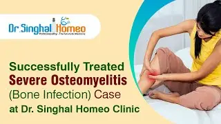 Discover Effective Osteomyelitis Treatment in Homeopathy with Dr. Vikas Singhal #osteomyelitis