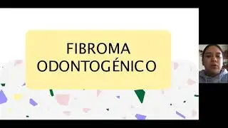 PIA. Patolog&iacute;a oral I. Fibroma odontog&eacute;nico. Alumna: Garc&iacute;a Cuevas Nelifer Jerusalem