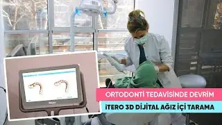 Ortodonti Tedavisinde Devrim | iTero 3D Dijital Ağız İçi Tarayıcı