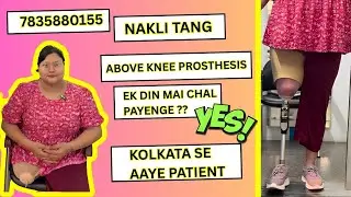 Necklace to knee joint | #necklace #artificiallimb #bestprostheticclinic